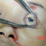 Dead woman with tored pussy