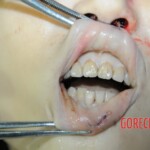 Dead woman with tored pussy