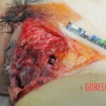 Dead woman with tored pussy