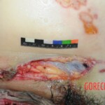 Dead woman with tored pussy