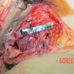 Dead woman with tored pussy