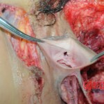 Dead woman with tored pussy