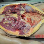 Dead woman with tored pussy