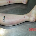 Dead woman with tored pussy