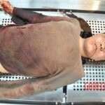 Stabbed Chinese girl in morgue