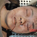 Stabbed Chinese girl in morgue