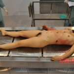 Stabbed Chinese girl in morgue