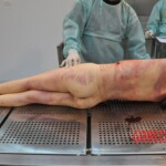 Stabbed Chinese girl in morgue