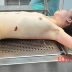 Stabbed Chinese girl in morgue