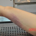 Stabbed Chinese girl in morgue