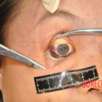 Stabbed Chinese girl in morgue