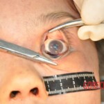 Stabbed Chinese girl in morgue