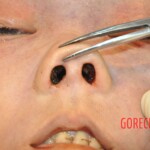 Stabbed Chinese girl in morgue