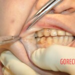 Stabbed Chinese girl in morgue