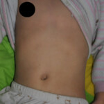 Two little sisters poisoned by carbon monoxide