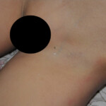 Two little sisters poisoned by carbon monoxide