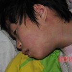 Two little sisters poisoned by carbon monoxide