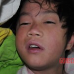 Two little sisters poisoned by carbon monoxide