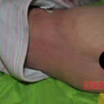 Two little sisters poisoned by carbon monoxide