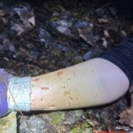 Bear attack in Slovakia