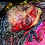 Bear attack in Slovakia