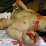 Traffic accident aftermath