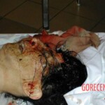 Traffic accident aftermath