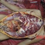 Girl brutally stabbed to death