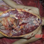 Girl brutally stabbed to death