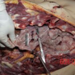 Young Chinese woman brutally stabbed to death in her bed