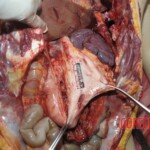 Young Chinese woman brutally stabbed to death in her bed