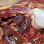 Young Chinese woman brutally stabbed to death in her bed