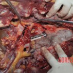 Young Chinese woman brutally stabbed to death in her bed