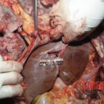 Young Chinese woman brutally stabbed to death in her bed