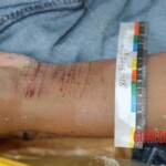 Chinese girl suicide