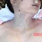 Chinese girl suicide