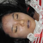 Examination of female corpse