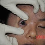 Examination of female corpse