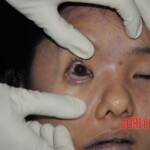 Examination of female corpse