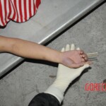 Examination of female corpse