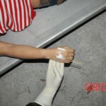 Examination of female corpse