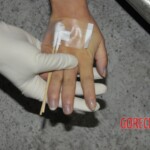 Examination of female corpse