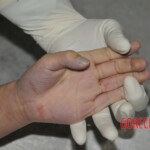 Examination of female corpse