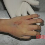 Examination of female corpse