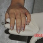 Examination of female corpse