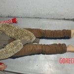 Examination of female corpse