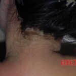 Suicide by poisoning