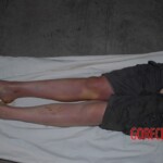 Suicide by poisoning