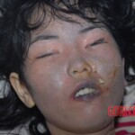 Suicide by poisoning