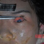 Suicide by poisoning